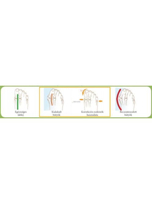 QMED harántemelő párna (1 pár / doboz)